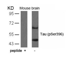 Tau, p Ser396 Antibody, Novus Biologicals:Antibodies:Primary Antibodies